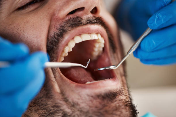 Best Broken or Chipped Tooth Repair in Southmont, PA